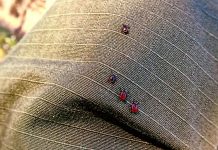 UK citizen falls prey to Tick-borne encephalitis