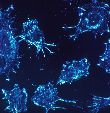 Cancertame: Finally, An Effective Remedy For Cancer